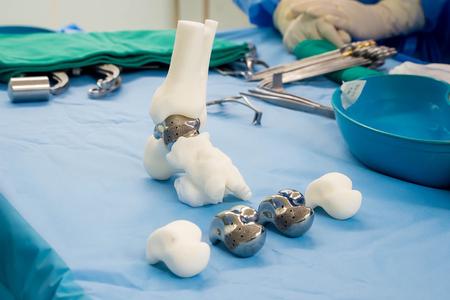Kỹ thuật đặc biệt tại Vinmec “hồi sinh” đôi chân cho chàng trai 23 tuổi trước bờ vực tàn phế